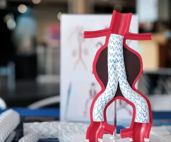 Kapalı Yöntem Aort Ameliyatları Kapalı Yöntem Aort Ameliyatları