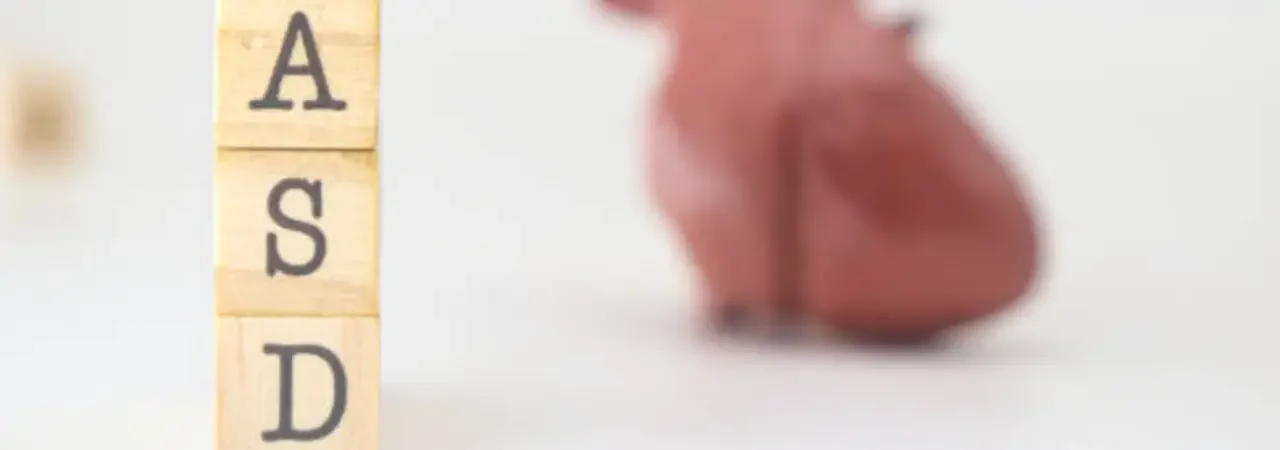 Atriyal Septal Defekt (ASD)'de Ne Zaman Ameliyat Olmalı?