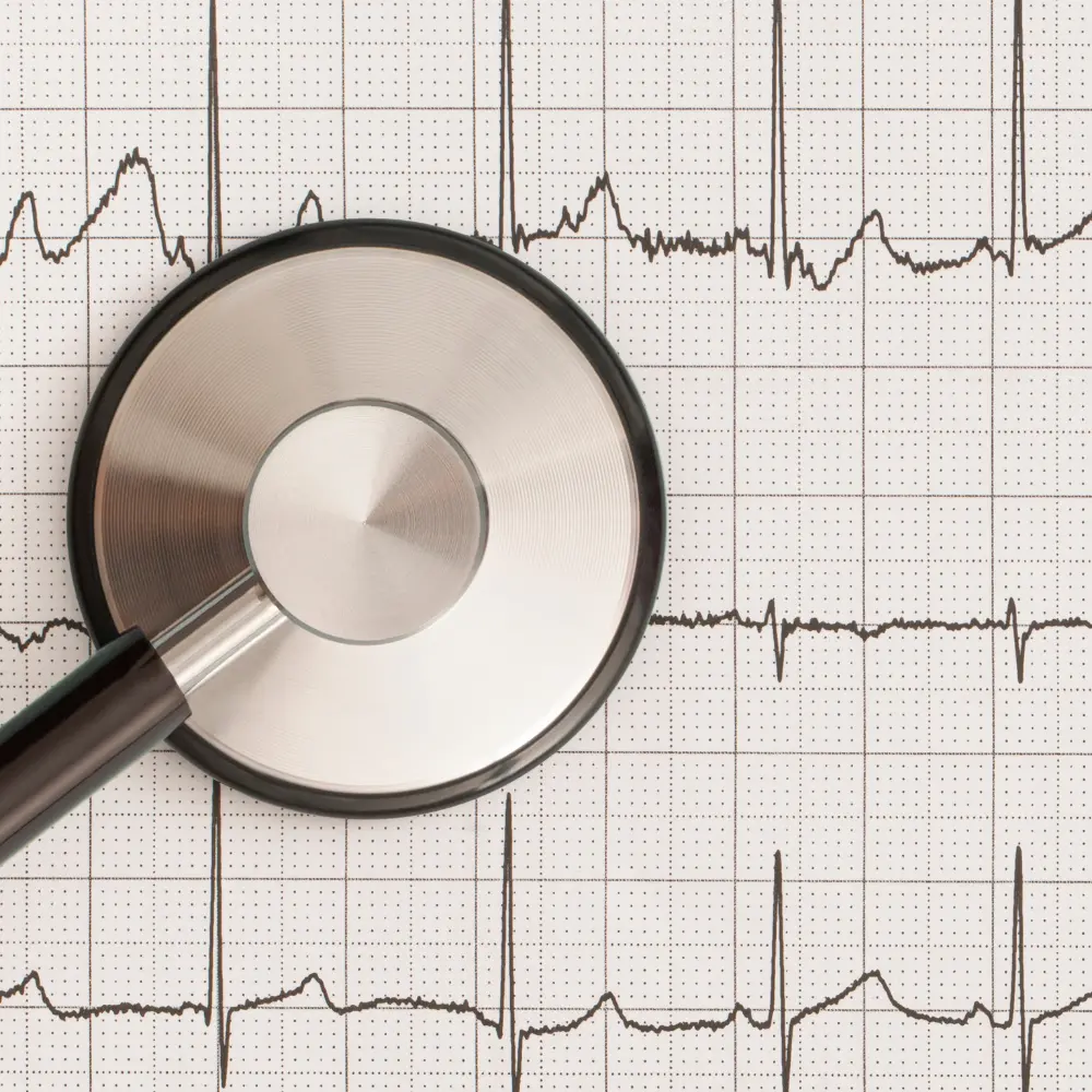 Palpitations / Cardiac Arrhythmia