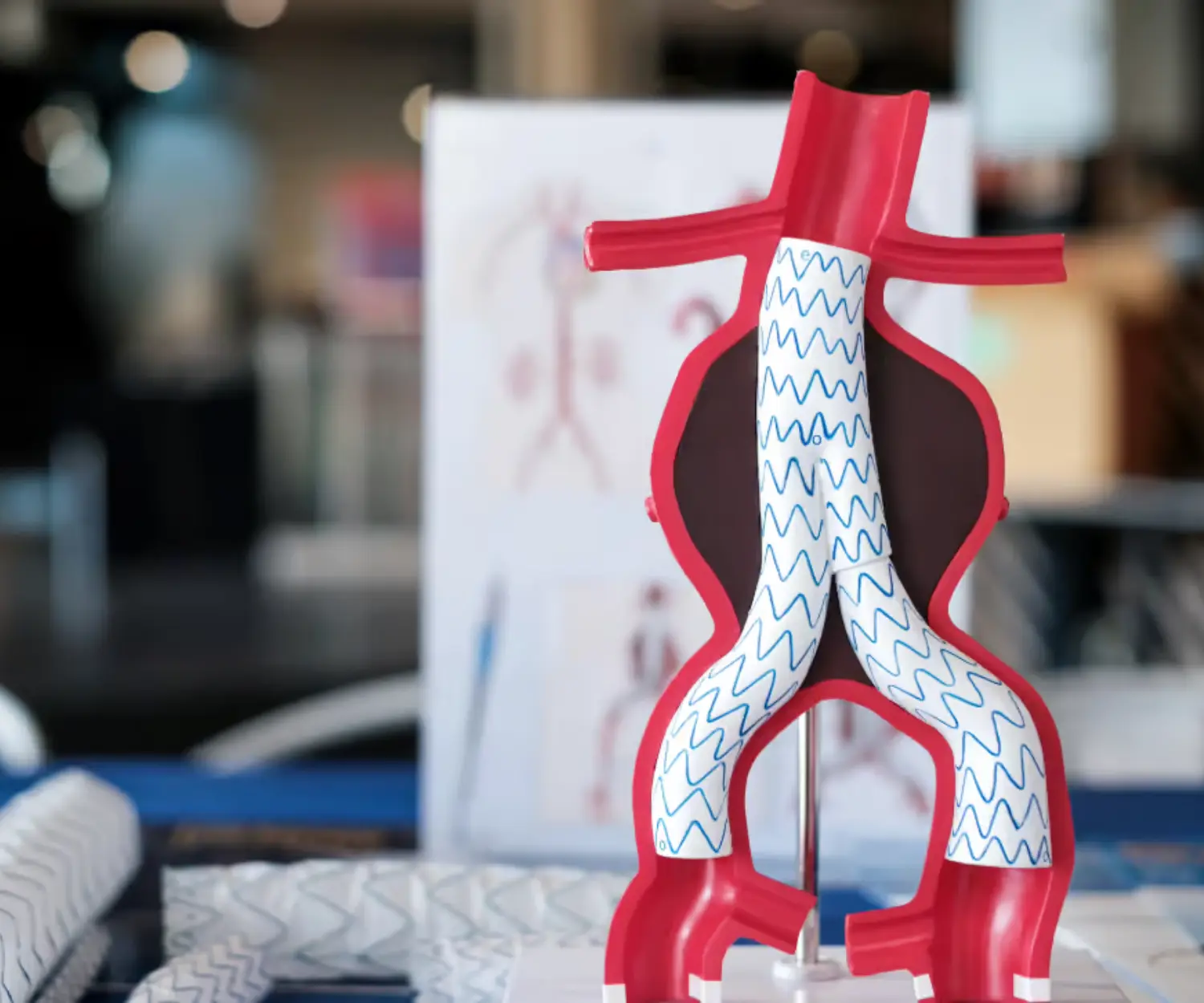 Aortic Surgery & Endovascular Repair