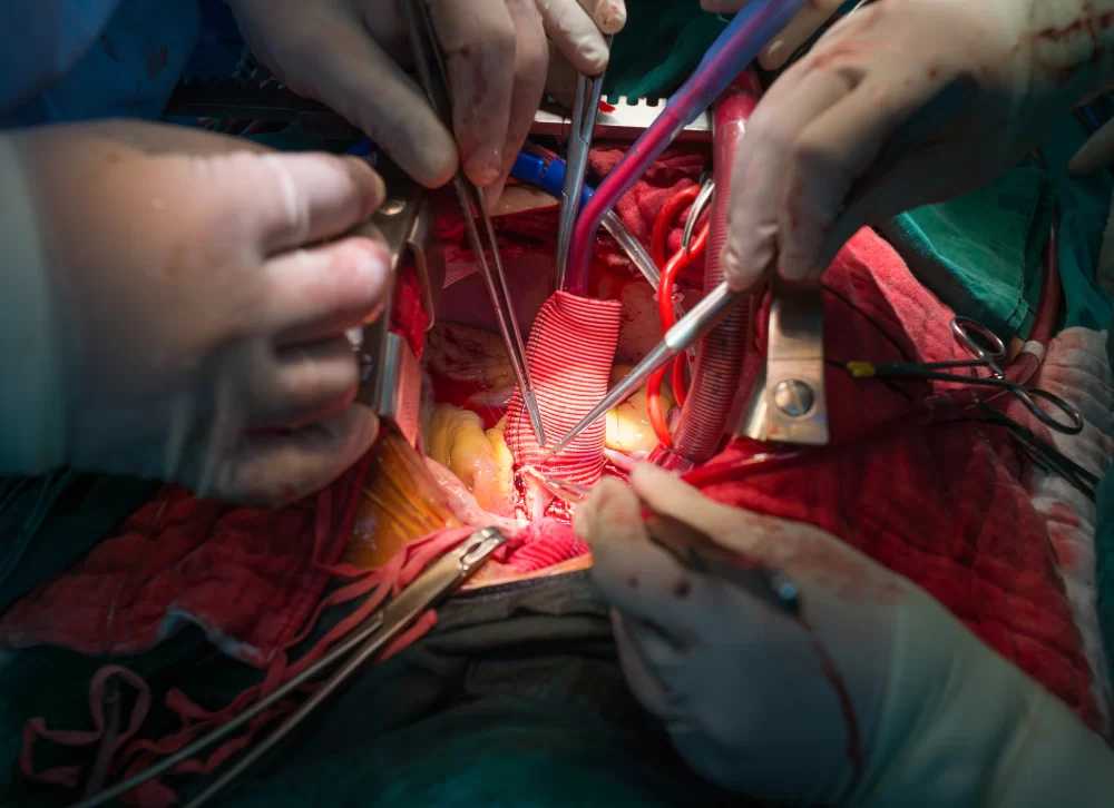 Bental Ameliyatı ile İyileşme Süreci